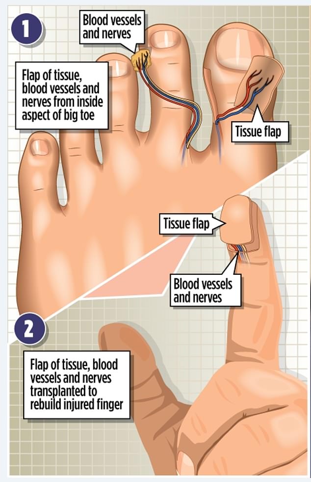 3-the_complex_operation_surgeons_took_an_inch_square_sectio-a-71_1701559387413