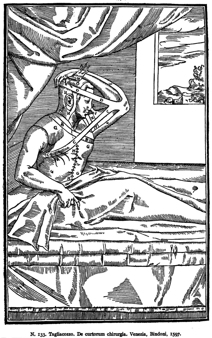 57