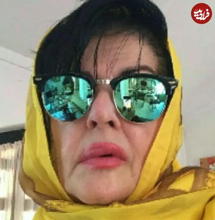 alireza.mgh125_1548524917_1965491926419334370_5827691844