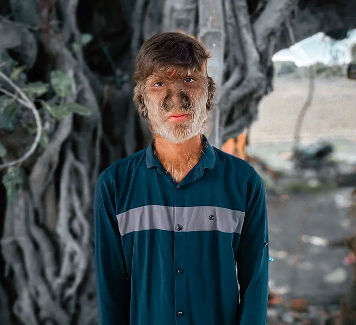 rare-genetics-unique-people-70-653908ded1461__700