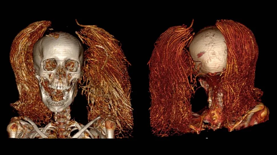 (عکس) راز فریاد منجمد شده یک زن مومیایی به مدت 3500 سال