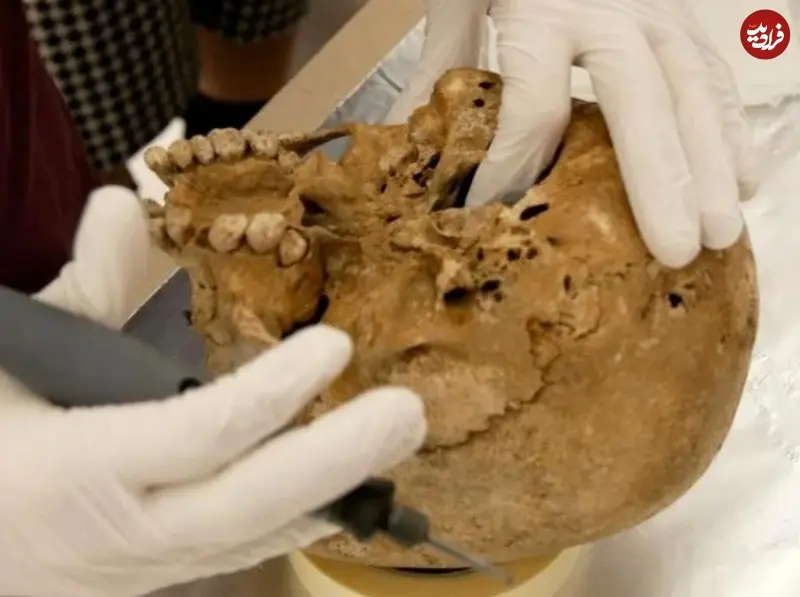 کوتولگی نادر باستانی 2