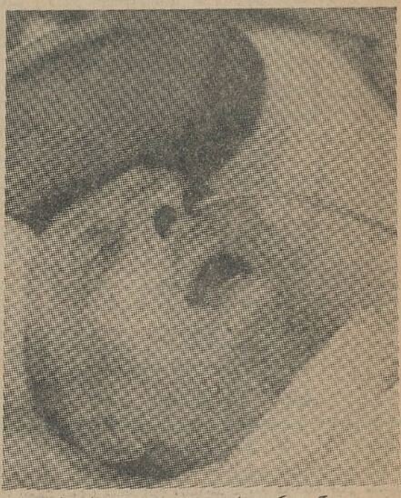 75