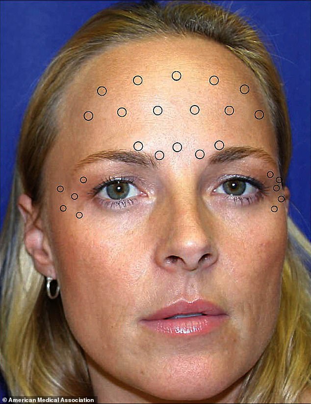 4-d_are_the_spots_that_one_twin_had_Botox_injections_in_the-a-26_1705738121951