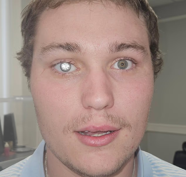 41