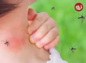 کودکتان را حشره گزیده؟ /این علائم را جدی بگیرید