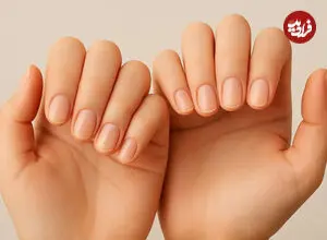 شکل و ظاهر ناخن شما درباره سلامتی چه می گوید؟ + اینفوگرافیک