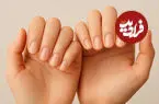 شکل و ظاهر ناخن شما درباره سلامتی چه می گوید؟ + اینفوگرافیک