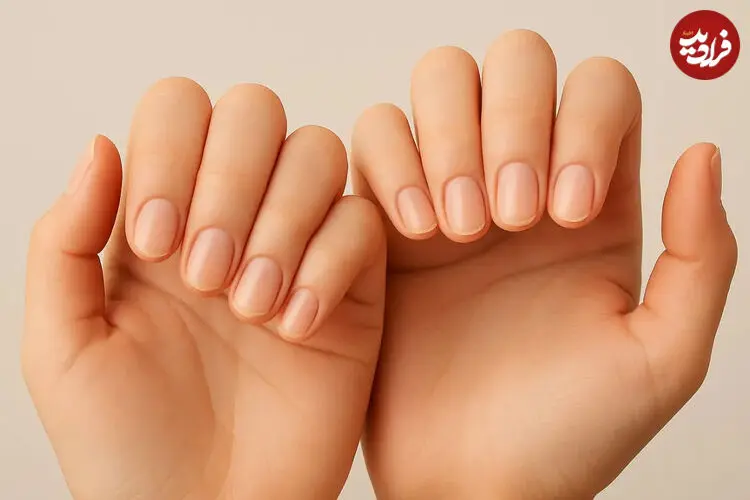 شکل و ظاهر ناخن شما درباره سلامتی چه می گوید؟ + اینفوگرافیک