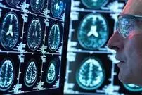 شمارش معکوس برای پایان عصر شیمی‌درمانی؛ فرمان مرگ برای سلول‌های سرطانی