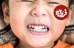 راز دندان قروچه در خواب که هیچکس نمی‌گوید؛ چطور کنترل کنیم؟