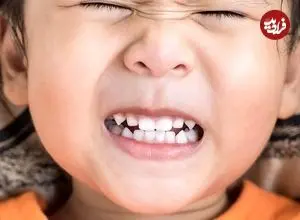 راز دندان قروچه در خواب که هیچکس نمی‌گوید؛ چطور کنترل کنیم؟