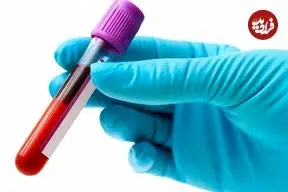 رنگ های عجیب خون در دنیای موجودات زنده + اینفوگرافیک