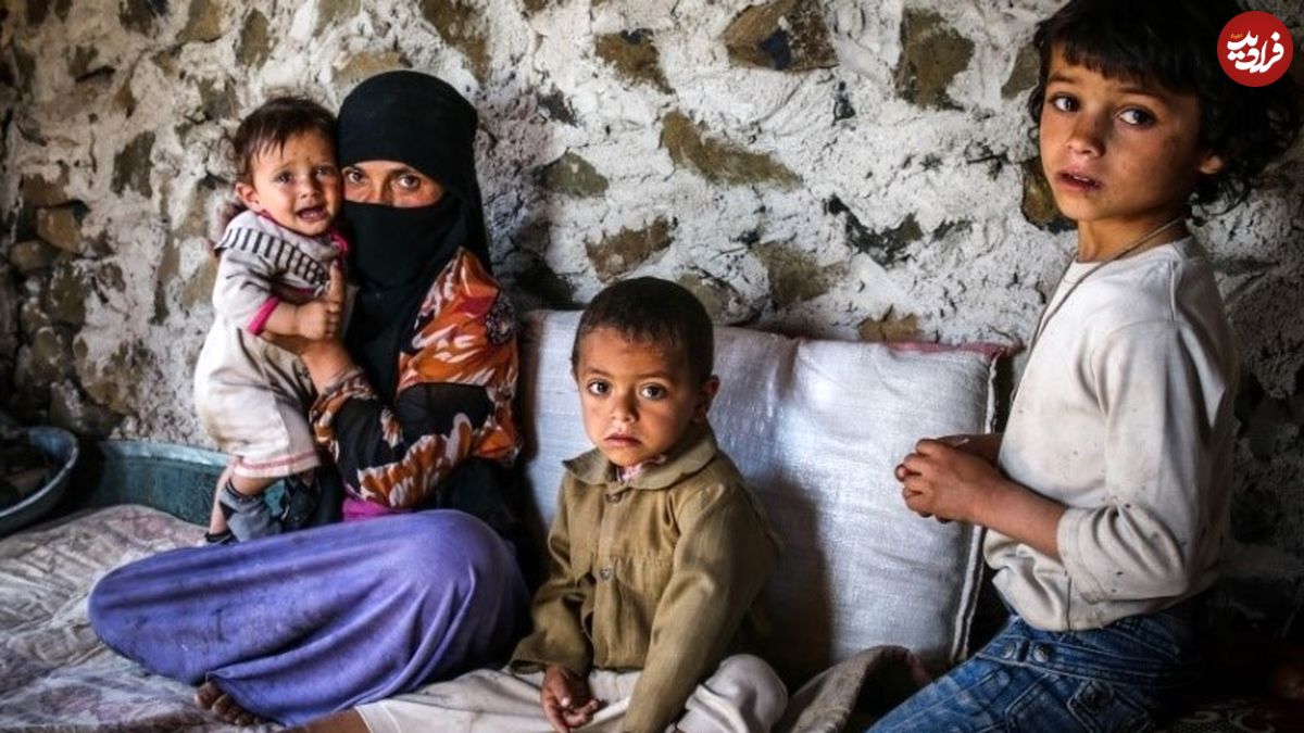 کودکان استخوانی یمنی می‌میرند؛ به خاطر یک تکه نان