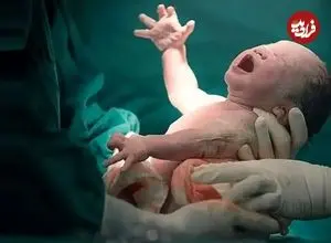 آمار زایمان‌های اورژانسی تهرانی‌ها در آمبولانس و خانه