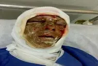 تصاویر +16/ انفجار مرگبار مواد محترقه در اشنویه