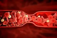 چند نکته مهم برای جلوگیری از لخته نشدن خون در بدن