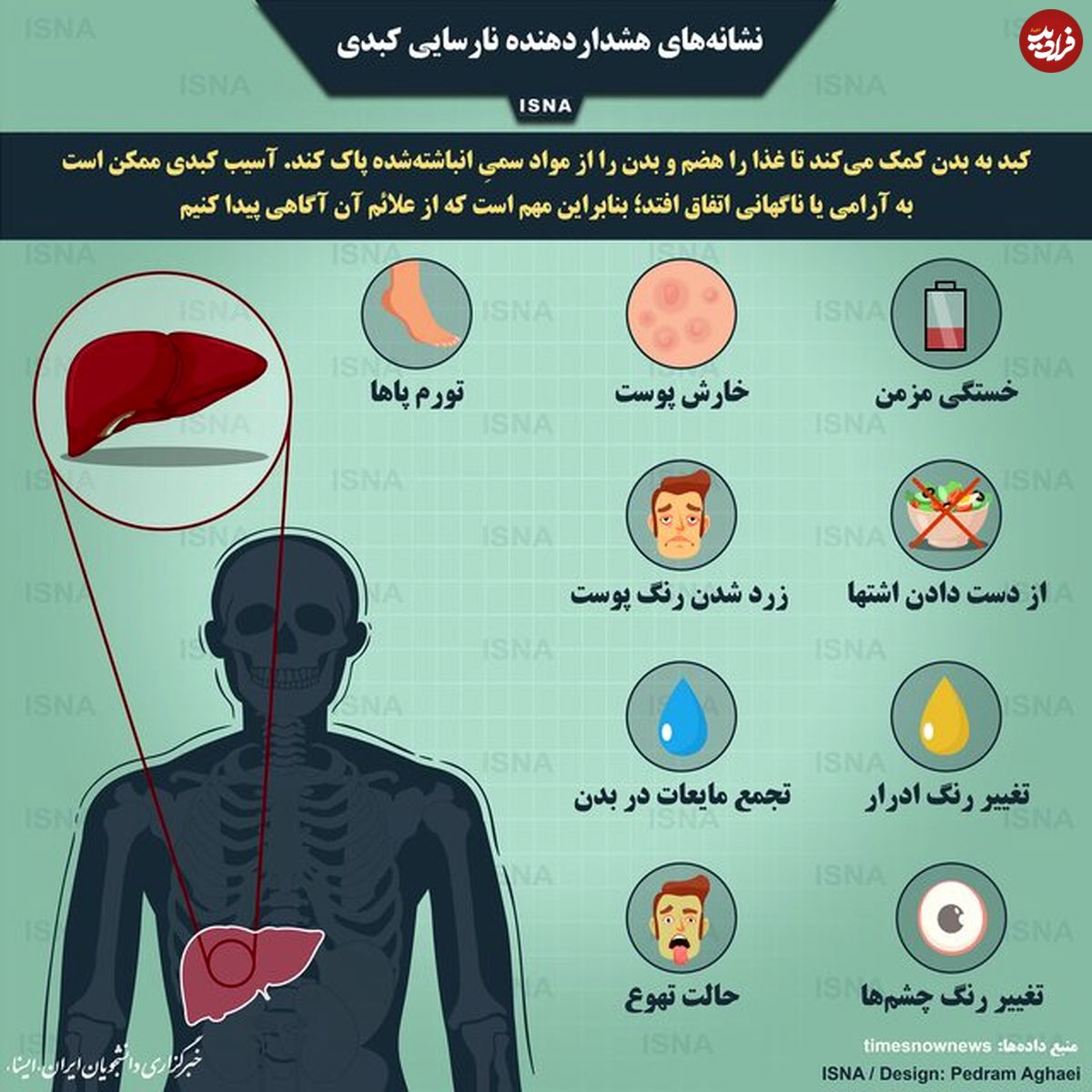 تصویر/ نشانههای هشداردهنده نارسایی کبدی