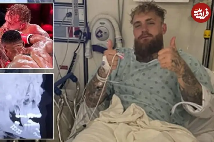 عکس؛ ژست میلیونی جیک پاول پس از شکست سنگین در برابر آنتونی جاشوا و جراحی فک