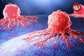 این باورهای اشتباه درباره سرطان را دور بریزید