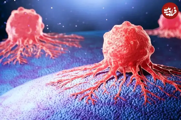 این باورهای اشتباه درباره سرطان را دور بریزید