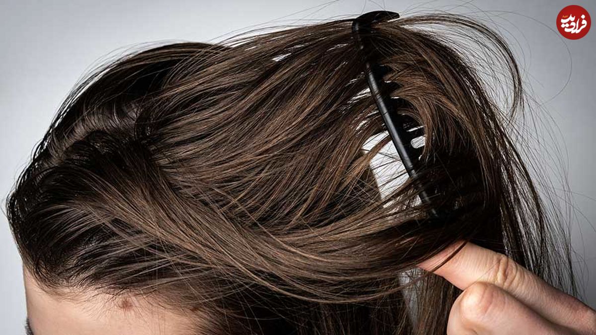 ۱۷ راهکار برای خلاص شدن از موی چرب
