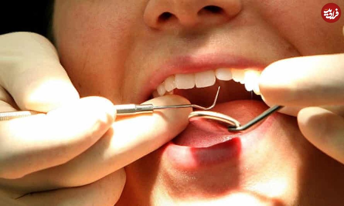 آیا رشد مجدد دندان‌های دائمی امکان پذیر است؟