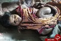 عکس/ دختر ۲۵ ساله‌ای که هر روز آب می‌رود