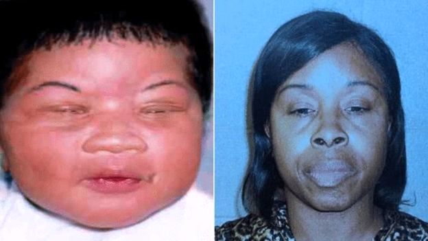 نوزاد ربوده شده پس از ۱۸ سال پیدا شد