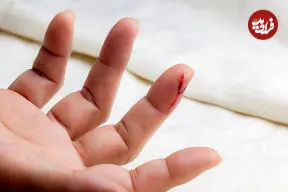 چرا انسان توانایی بازسازی اندام‌های خود را ندارد؟ پژوهشی تازه پاسخ می‌دهد