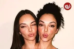 تصاویر| جنجال دوقلوهای به‌هم‌چسبیده مشهور در اینستاگرام که فیک از آب درآمدند!