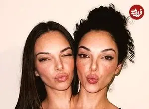 تصاویر| جنجال دوقلوهای به‌هم‌چسبیده مشهور در اینستاگرام که فیک از آب درآمدند!