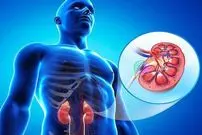 علائم رایج بیماری کلیوی کدام است؟