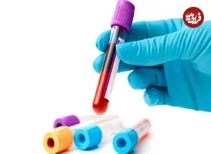 گفت و گو با مردی که خونش در ایران کمیاب‌تر از الماس است