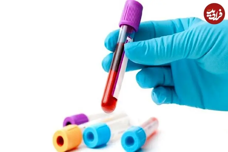 گفت و گو با مردی که خونش در ایران کمیاب‌تر از الماس است