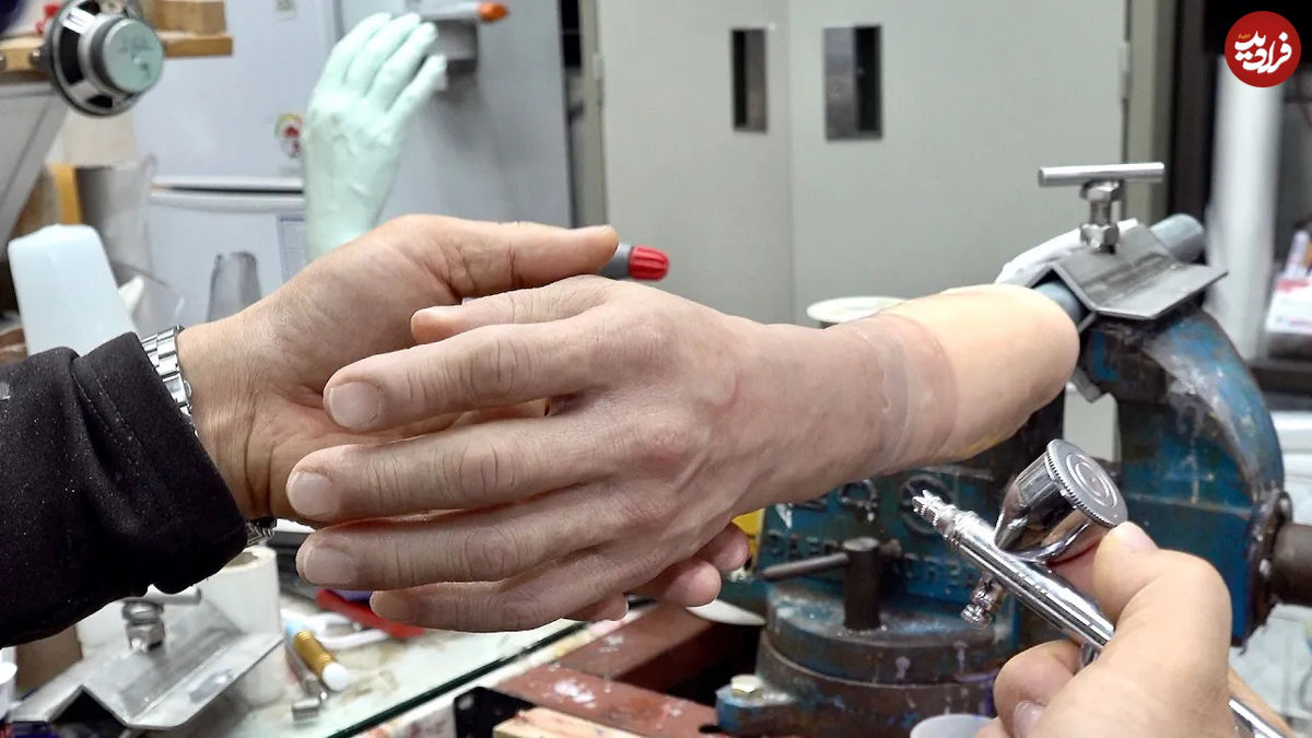 (ویدئو) عملیات شگفت انگیز ساخت دست و بازوی مصنوعی در کره جنوبی 
