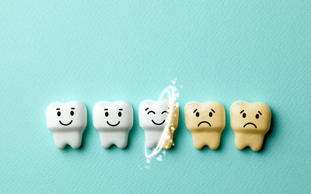 ۱۰ علت برای زرد شدن دندان‌ ها و روش‌ های ساده برای سفید کردن دندان در خانه