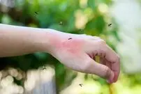 تصاویر| ۵ گیاه معطر که پشه‌ها را از شما دور می‌کنند
