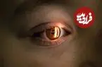 ژاپنی‌ها دلیل اصلی کوررنگی را کشف کردند