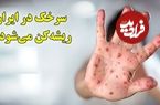 ببینید؛ ریشه‌کنی سرخک در ایران در معرض خطر؛ افزایش موارد ابتلا در جهان
