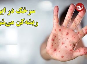 ببینید؛ ریشه‌کنی سرخک در ایران در معرض خطر؛ افزایش موارد ابتلا در جهان