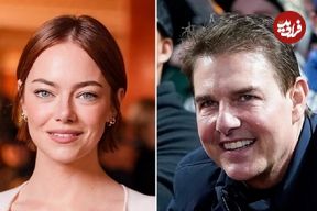 دلایل افزایش جراحی‌های زیبایی ناموفق در میان سلبریتی‌ها و ظاهر غیرطبیعی آن‌ها