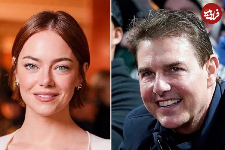 دلایل افزایش جراحی‌های زیبایی ناموفق در میان سلبریتی‌ها و ظاهر غیرطبیعی آن‌ها