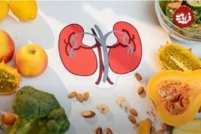 برای کلیه درد چی بخوریم؟