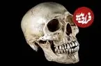 سبک زندگی مدرن در صد سال اخیر جمجمه انسان را دگرگون کرده است