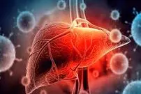 پنج علامت مهم ابتلا به کبد چرب