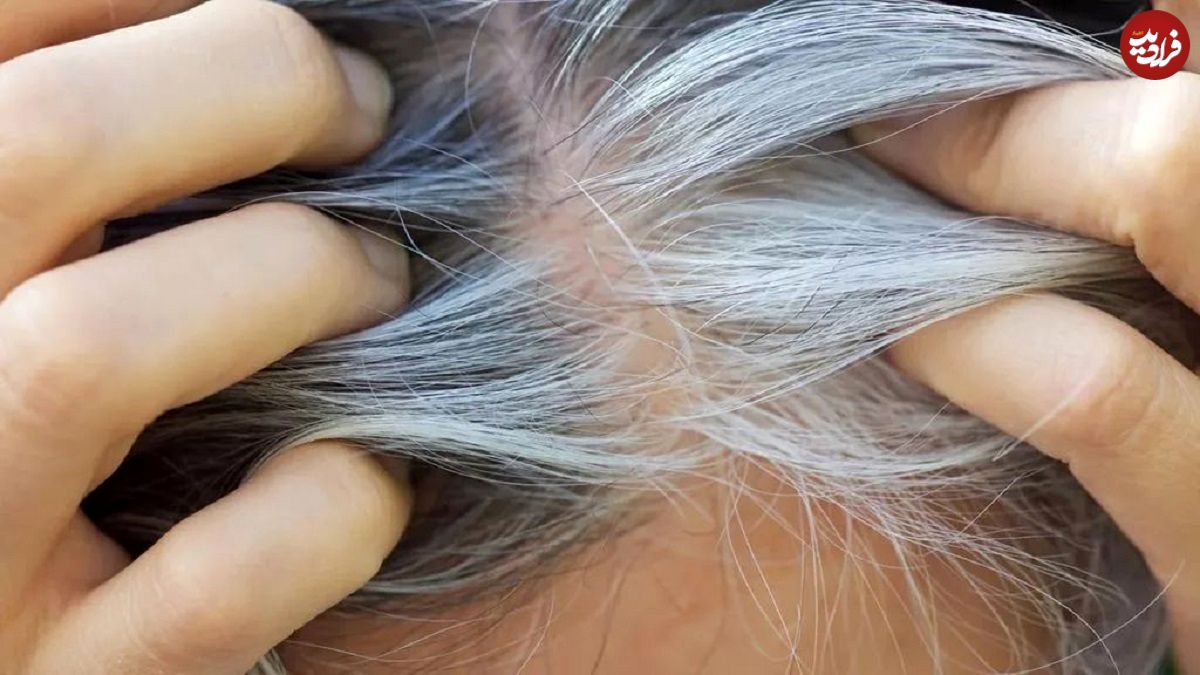 مطالعه جدید ارتباط پنهان میان سفیدی مو و سرطان را نشان میدهد
