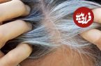 مطالعه جدید ارتباط پنهان میان سفیدی مو و سرطان را نشان میدهد
