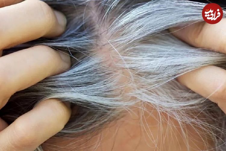 مطالعه جدید ارتباط پنهان میان سفیدی مو و سرطان را نشان میدهد