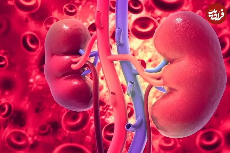 مرد هندی برای درمان عفونت ادراری به پزشک مراجعه کرد و فهمید سه کلیه‌ دارد